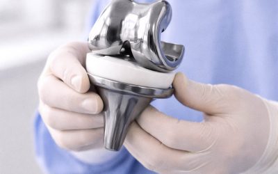 Cuándo es necesaria una prótesis de rodilla